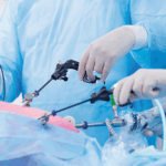 La laparoscopia è una “chirurgia dolce”?